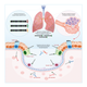 An graphic on the basics of how Arap and his team’s inhalable vaccine is supposed to work